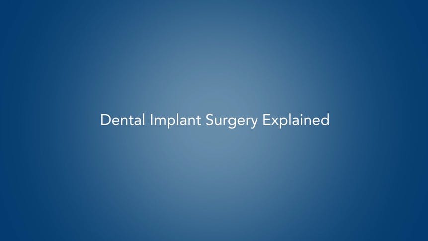 Dental Implants Explained Dental Implants Explained